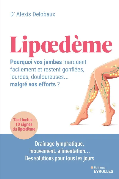 Visuel de Lipoedème : pourquoi vos jambes marquent facilement et restent gonflées, lourdes, douloureuses... malgré vos efforts ?