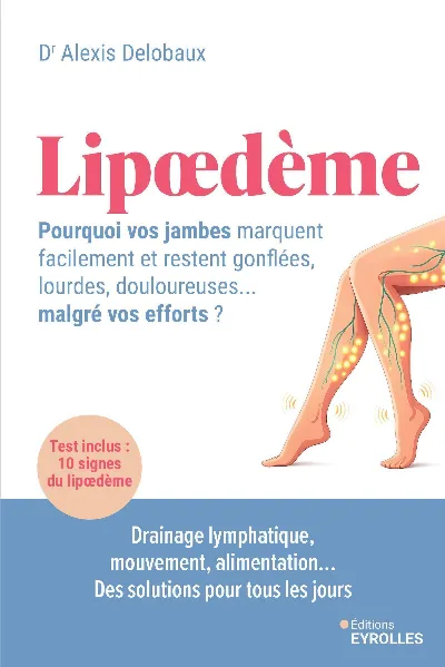 Visuel de Lipoedème : pourquoi vos jambes marquent facilement et restent gonflées, lourdes, douloureuses... malgré vos efforts ?